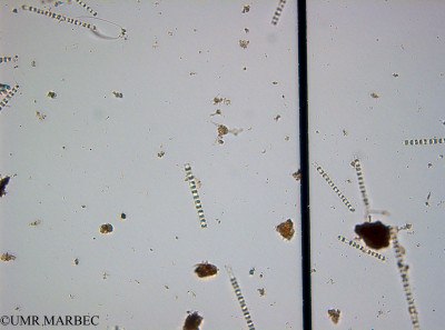 phyto/Guinea golf/Wouri_estuary_Chenal_2/YNkouefuthNfongmo_these 2022-2023/Staurastrum sp (Chenal2_SURF_2023_iden17230626_001).TIF(copy)_thumb.jpg